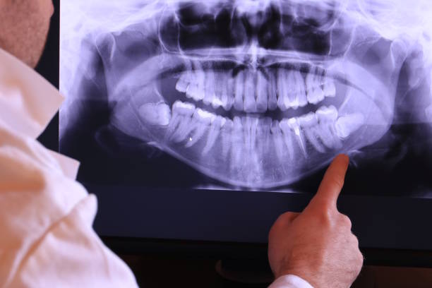 Best Emergency Dental Extractions in Naples, TX
