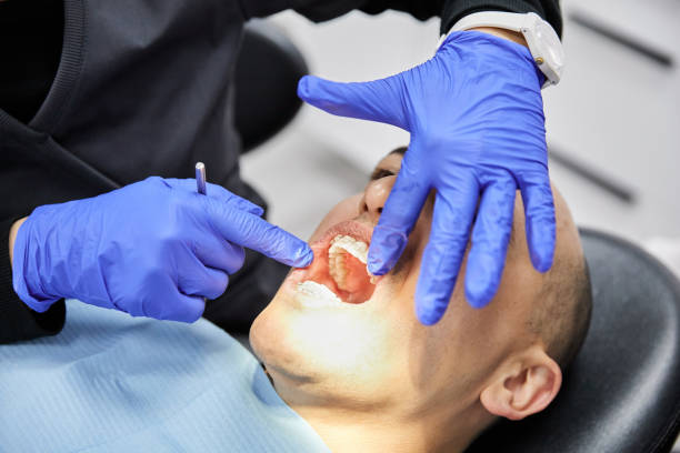 Best Broken or Cracked Tooth Emergency Dentist in Naples, TX